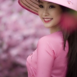  Niềng răng hô do răng bị chìa ra phía trước