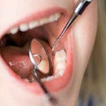 Tại sao cần phải bỏ công để trám những răng cối sữa?