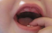 Cách chăm sóc khi trẻ mọc răng