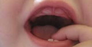 Để chăm sóc trẻ tốt khi mọc răng