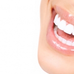 Cười hở nướu do răng khi có tình trạng hô hay răng mọc dài 