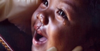 Lịch mổ khe hở môi,hàm ếch năm 2010 tại bệnh viện Răng Hàm Mặt