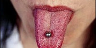 Đeo khoen lưỡi "gây hại cho răng" 