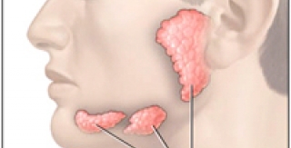 Ung thư tuyến nước bọt