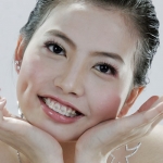 Tái tạo nụ cười thẩm mỹ