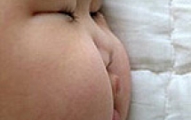 Vài điều bạn cần biết để giúp trẻ giảm béo phì 