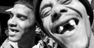 Nhổ răng cửa - mốt của giới trẻ !