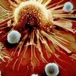 Vắc-xin HIV/AIDS: Thêm một hướng nghiên cứu mới 