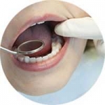 Tại sao có người sau nhổ răng thì đau rất nhiều có khi kéo dài hàng tuần? 