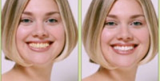 Chăm sóc răng miệng để hàm răng trẻ không bị ngả màu