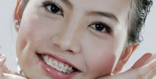 Tái tạo nụ cười thẩm mỹ