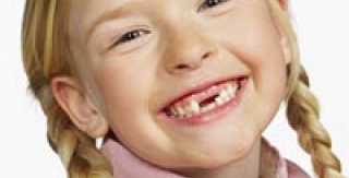 Sâu răng - Đừng chủ quan! 