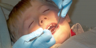 Phương pháp mới chữa răng sữa bị sâu