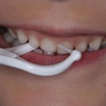 Phương pháp sử dụng bộ giữ chỉ nha khoa (dental floss holder)