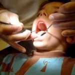 Khám răng, nha sĩ làm rớt kim vào họng bé 4 tuổi