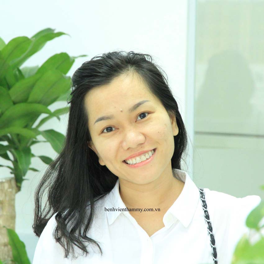 nieng rang ho b7