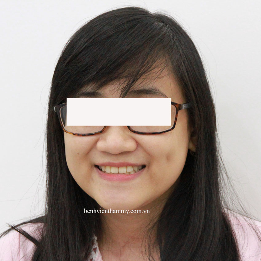 nieng rang mom chen chuc 5 copy