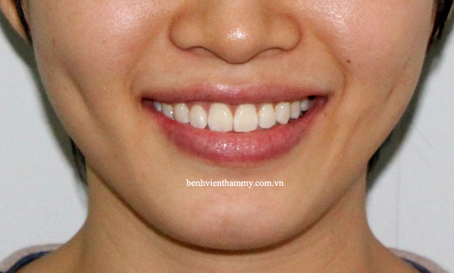 rang-chen-chuc-5 copy