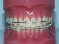 chinh-nha-su-tham-my