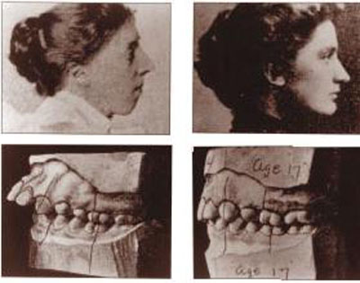 hinh-chinh-nha-angle